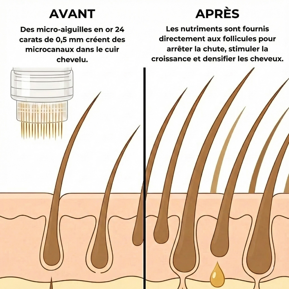 Novacell Microinfusion