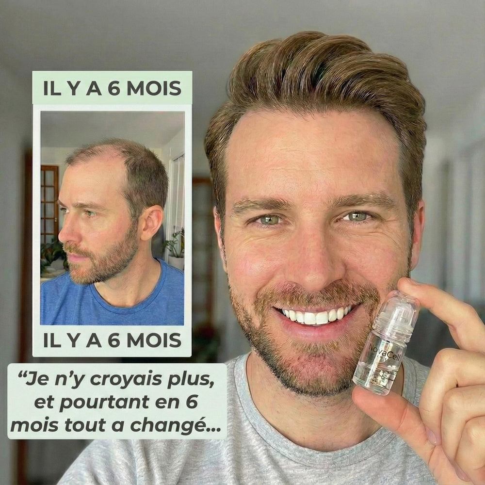 Novacell Microinfusion